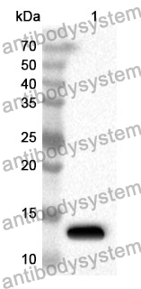 Anti-Human TRGV9/Vγ 9(TCR) Polyclonal Antibody